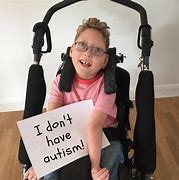 Image result for People with Disabled Face
