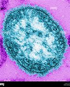 Image result for Sarampion Virus