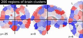 Image result for CC200 Brain Atlas