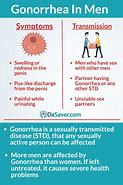 Image result for Gonorrhea of the Throat