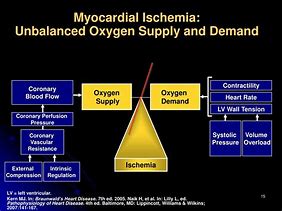 Image result for Demand Ischemia Types