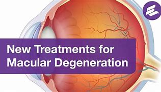 Image result for Laser Eye Treatment