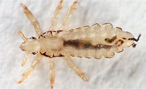 Image result for Body Lice Poop