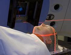 Image result for Radiation Therapy Body Mold
