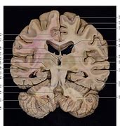 Image result for Brain 34 View