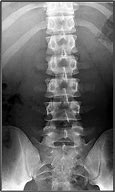 Image result for AP Lumbar Spine Anatomy