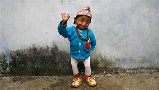 Image result for Most Smallest Person in the World