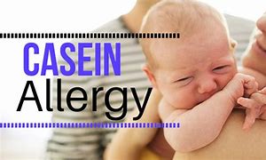 Image result for Casein Allergy