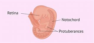 Image result for Symptoms at 5 Weeks Pregnant
