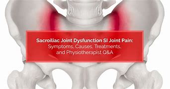 Image result for Sacroiliac Joint Dysfunction Pain