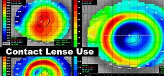 Image result for wide angle contact lenses