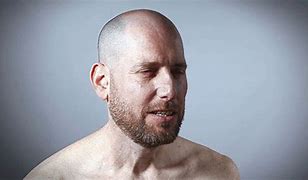 Image result for Distorted Bald Man