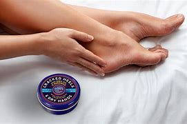 Image result for Blue Goo Cracked Heel Foot Softener