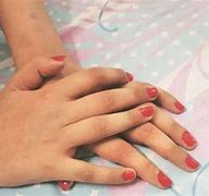 Image result for hand transplant