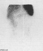Image result for Labelled White Cell Scan