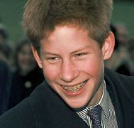 Image result for Prince Harry Early Pictures