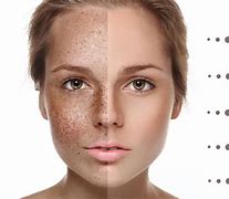 Image result for Tan Pigment On Skin