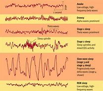Image result for Brain Activity during Sleep