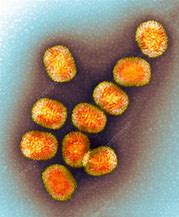 Image result for Molluscum Virus