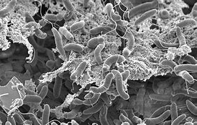 Image result for vibrio_cholerae