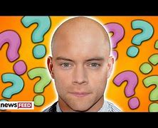 Image result for Harry Goes Bald