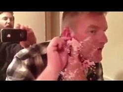 Image result for World's Biggest Pimple Ever Popped