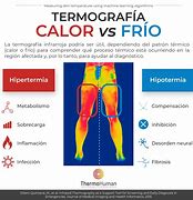Image result for calor�fwro