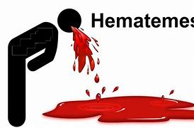 Image result for hematemedis