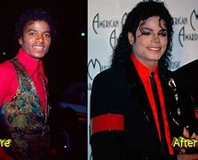Image result for Michaekl Jackson Before and After