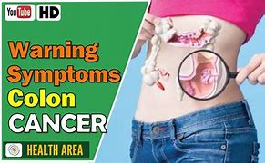 Image result for 5 Symptoms of Bowel Cancer