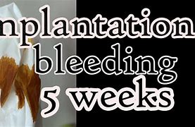 Image result for Bleeding 5 Weeks Pregnant