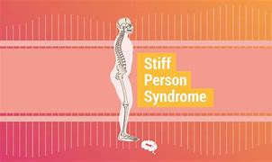 Image result for Short Man Syndrome