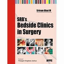 Image result for SRB Surgery