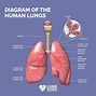 Image result for Lung Cancer Tumor Size Chart