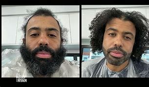 Image result for Daveed Diggs No Beard