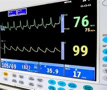Image result for Pulse Monitor Hospital
