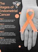 Image result for Endometrial Cancer Warning Signs