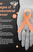 Image result for Endometrial Cancer