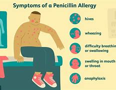 Image result for Saffron Allergy Symptoms