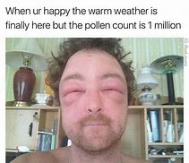 Image result for Almond Allergy Meme