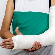 Image result for Down Syndrome and Broken Arm