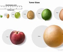 Image result for Grape Size in Cm