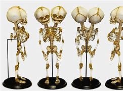 Image result for Two-Headed Skeleton