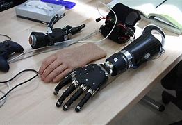 Image result for Mechanical Prosthetic Arm