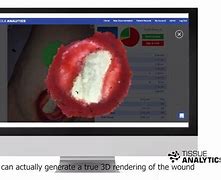 Image result for Tissue Analytics iPhone Screen Shot