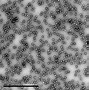 Image result for Parvovirus B19 Electron Microscope
