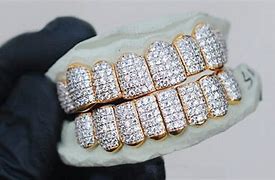 Image result for How Much Do Grillz Cost