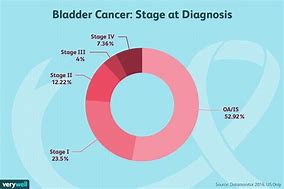 Image result for Bladder Cancer Tumor Size