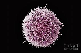 Image result for Cervical Cancer Cells