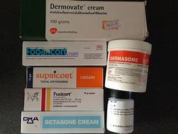 Image result for Topical Steroid Creams for Eczema